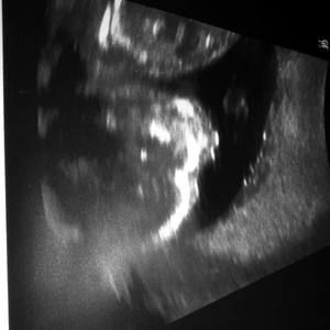 Meet your Posher, Destini